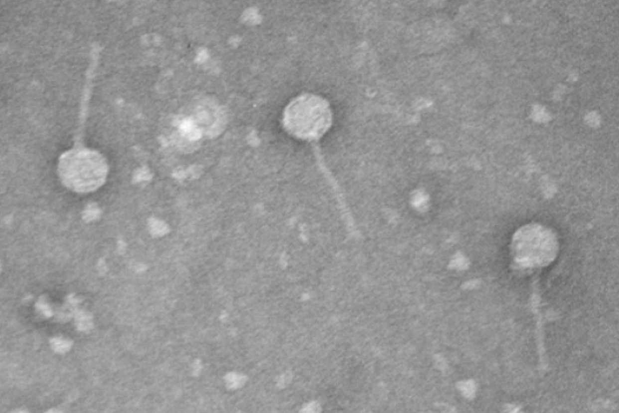 This is an image of the bacteriophage named Otwor discovered by APSU students.